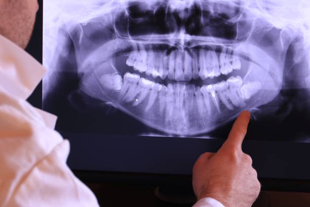 Best Cracked Tooth Emergency Dentist  in Decorah, IA