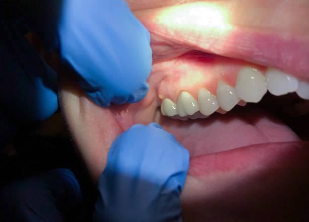 Best Root Canal Emergency Dentist  in Decorah, IA