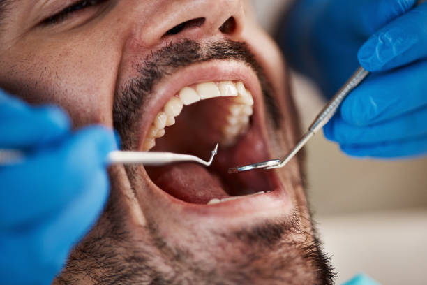 Best Knocked-Out Tooth Emergency  in Decorah, IA